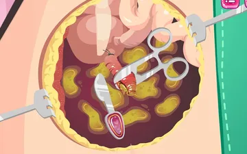 Beauty Ella Appendix Surgery