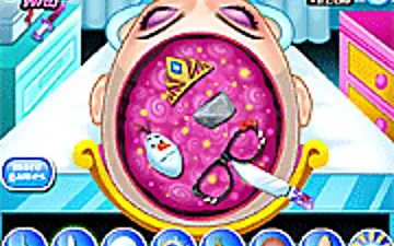 Elsa Frozen Brain Surgery