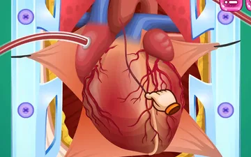 Heart Bypass Surgery