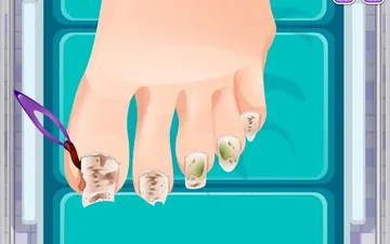 Blonde Sofia: Ingrown Toenail