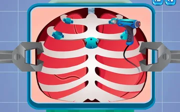 Lung Surgery