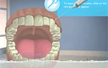 Glenn Martin Dental Adventure