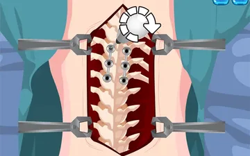 Princess Scoliosis Surgery