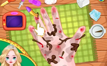 Princess Anna Hand Doctor