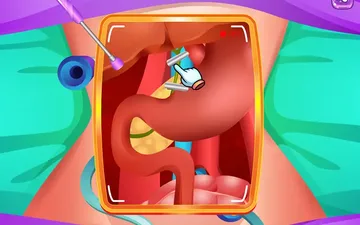 Princess Gallbladder Surgery