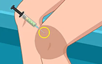 School Girl Knee Surgery